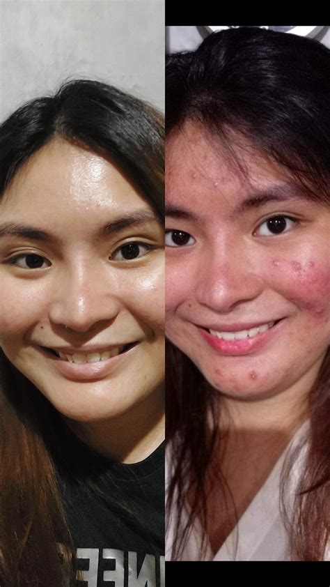 Sa lahat ng Moisturizer na nasubukan ko, ito ang tumapos ng .